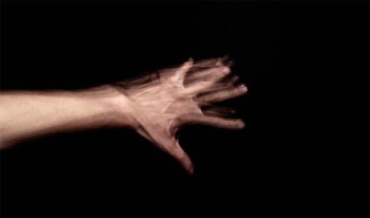 alien hand syndrome 768x454